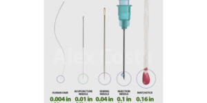 Akupunktioneulan paksuus (0.25mm) verrattuna hiukseen (0.1mm), ompeluneulaan (1mm), injektioneulaan (2.5mm) ja tulitikkuun (4mm).